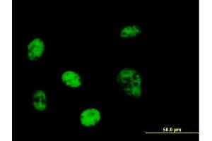Immunofluorescence of purified MaxPab antibody to PPP1R7 on HeLa cell.