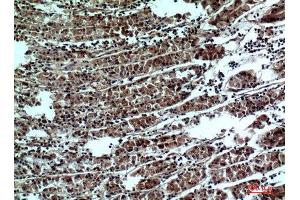 Immunohistochemistry (IHC) analysis of paraffin-embedded Human Stomach, antibody was diluted at 1:100. (PPP1R15B 抗体  (Internal Region))