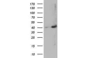 HEK293T cells were transfected with the pCMV6-ENTRY control (Left lane) or pCMV6-ENTRY MAGEB18 (Right lane) cDNA for 48 hrs and lysed. (MAGEB18 抗体)