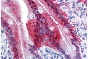 Human Small Intestine: Formalin-Fixed, Paraffin-Embedded (FFPE)