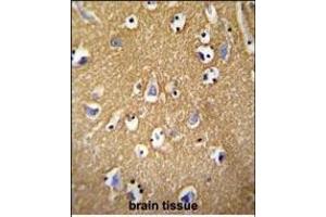BCAN antibody (C-term) (ABIN652096 and ABIN2840547) immunohistochemistry analysis in formalin fixed and paraffin embedded human brain tissue followed by peroxidase conjugation of the secondary antibody and DAB staining.