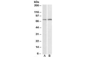 Western blot testing of HepG2 [A] and K562 [B] lysates with CYP2B6 antibody at 0. (CYP2B6 抗体)
