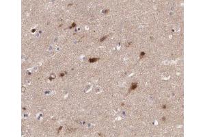 ABIN6266568 at 1/200 staining human brain tissue sections by IHC-P. (PRAF2 抗体  (C-Term))