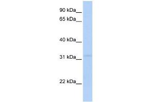 WB Suggested Anti-MTCH2 Antibody Titration: 0. (MTCH2 抗体  (N-Term))