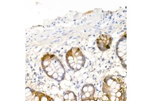 Immunohistochemistry of paraffin-embedded human small intestine using DDC Rabbit pAb (ABIN1679510, ABIN3018150, ABIN3018151 and ABIN6220384) at dilution of 1:25 (40x lens). (DDC 抗体  (AA 1-100))