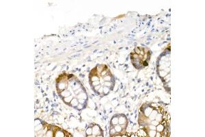 Immunohistochemistry of paraffin-embedded human small intestine using DDC Rabbit pAb (ABIN1679510, ABIN3018150, ABIN3018151 and ABIN6220384) at dilution of 1:25 (40x lens). (DDC 抗体  (AA 1-100))