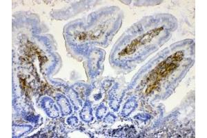 IHC testing of FFPE mouse intestine tissue with LYN antibody at 1ug/ml. (LYN 抗体  (AA 470-501))