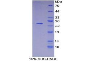 SDS-PAGE analysis of Pig MHCDRa Protein. (HLA-DRA 蛋白)