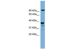 WB Suggested Anti-LAMP1 Antibody Titration: 0. (LAMP1 抗体  (N-Term))