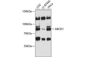Western blot analysis of extracts of various cell lines, using  antibody (ABIN6129183, ABIN6136369, ABIN6136370 and ABIN6215725) at 1:3000 dilution. (ABCD1 抗体  (AA 340-500))
