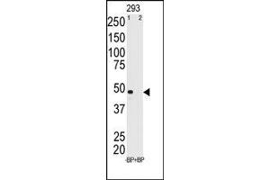 Image no. 2 for anti-Melanoma Antigen Family A, 11 (MAGEA11) (N-Term) antibody (ABIN358642) (MAGEA11 抗体  (N-Term))