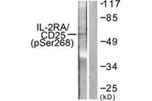 Western blot analysis of extracts from LOVO cells, using IL-2R alpha/CD25 (Phospho-Ser268) Antibody. (CD25 抗体  (pSer268))