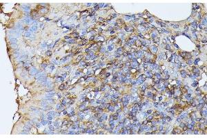 Immunohistochemistry of paraffin-embedded Rat lung using STK24 Polyclonal Antibody at dilution of 1:100 (40x lens). (STK24 抗体)