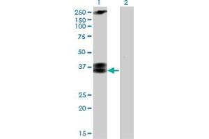 Western Blot analysis of CACNG3 expression in transfected 293T cell line by CACNG3 monoclonal antibody (M01), clone 3E4. (CACNG3 抗体  (AA 199-297))