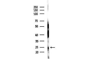 Western blot analysis of lysates from HepG2 cells(heat-shock,45 min treatment), using Phospho-p27 Kip1 (Thr187) Antibody at 1/1000 dilution.