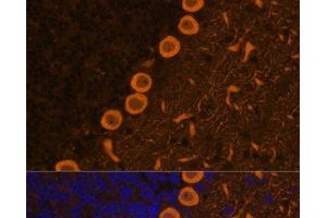 Immunofluorescence analysis of Rat brain cells using PRKCG Polyclonal Antibody at dilution of 1:100. (PKC gamma 抗体)