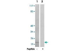 Western blot analysis of extracts from HT-29 cells, using PPP1R14A polyclonal antibody . (CPI-17 抗体)