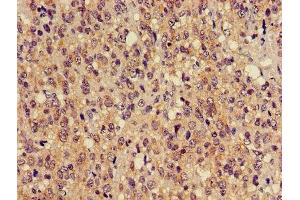 Immunohistochemistry (IHC) image for anti-Tubulin, Alpha, 3C (TUBA3C) (AA 161-418) antibody (ABIN7173663)