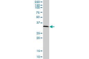 ASPA MaxPab rabbit polyclonal antibody. (ASPA 抗体  (AA 1-313))