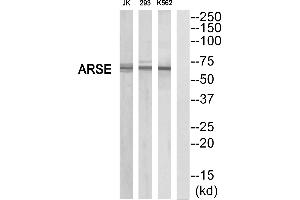 Western blot analysis of extracts from K562/293/Jurkat cells, using ARSE antibody. (Arylsulfatase E 抗体  (Internal Region))