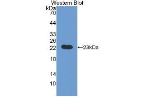 Detection of Recombinant vHL, Rat using Polyclonal Antibody to Von Hippel Lindau Tumor Suppressor (vHL) (VHL 抗体  (AA 6-175))