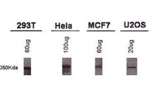 Western blot analysis of BRCA1 using BRCA1 monoclonal antibody, clone KEN . (BRCA1 抗体  (AA 1314-1864))