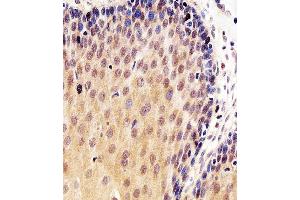 Immunohistochemical analysis of paraffin-embedded H. (p53 抗体  (AA 364-393))