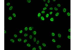 Immunofluorescence (IF) image for anti-Histone Cluster 1, H4a (HIST1H4A) (acLys20) antibody (ABIN7139171)