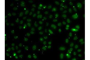 Immunofluorescence analysis of A549 cell using NSL1 antibody. (NSL1 抗体)