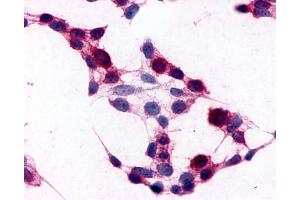 Anti-CD97 antibody immunocytochemistry (ICC) staining of HEK293 human embryonic kidney cells transfected with CD97. (CD97 抗体  (N-Term))