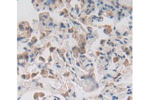 Used in DAB staining on fromalin fixed paraffin- embedded lung tissue (CDKN2D 抗体  (AA 1-166))