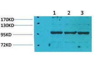 anti-Immunoglobulin-Like and Fibronectin Type III Domain Containing 1 (IGFN1) antibody