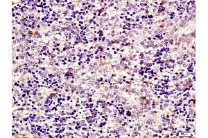Immunohistochemistry (IHC) image for anti-ATP-Binding Cassette, Sub-Family F (GCN20), Member 1 (ABCF1) (AA 501-600) antibody (ABIN675938)