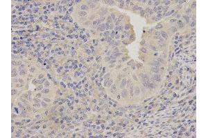 Immunohistochemistry (IHC) image for anti-Lipopolysaccharide-Induced Tumor Necrosis Factor-alpha Factor (LITAF) antibody (ABIN1876657) (LITAF 抗体)