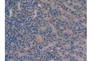 IHC-P analysis of Mouse Kidney Tissue, with DAB staining. (Versican 抗体  (AA 3058-3299))