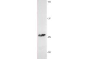 Western Blotting (WB) image for anti-Myelin Protein Zero (MPZ) antibody (ABIN953494) (MPZ 抗体)