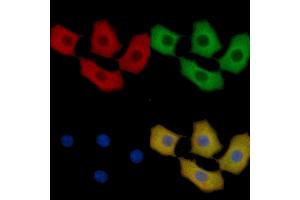 HSP70 Mouse Monoclonal Antibody staining HepG2 cells by IF/ICC. (HSP70 抗体  (C-Term))
