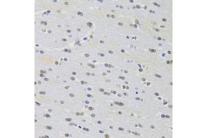 Immunohistochemistry of paraffin-embedded rat brain using PRPF3 Antibody (ABIN5973192) at dilution of 1/100 (40x lens). (PRPF3 抗体)