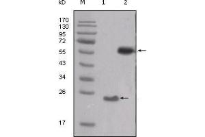 Western Blot showing SRC antibody used against truncated SRC-His recombinant protein (1) and PMA treated THP-1 cell lysate (2). (Src 抗体  (AA 10-193))
