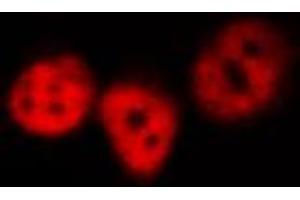 ABIN6267431 staining HeLa by IF/ICC.