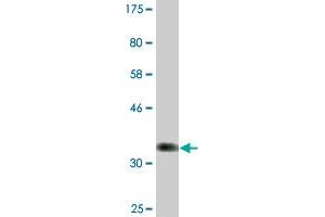 Western Blot detection against Immunogen (36. (NDOR1 抗体  (AA 498-595))