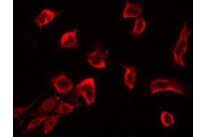 ABIN6272421 staining RAW264. (RSU1 抗体  (C-Term))