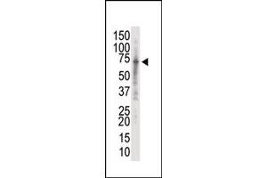 Image no. 1 for anti-Interleukin-1 Receptor-Associated Kinase 2 (IRAK2) (C-Term) antibody (ABIN360118) (IRAK2 抗体  (C-Term))