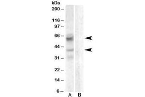 Western blot testing of A459 lysate with Arylsulfatase D antibody with [B] and without [A] blocking/immunizing peptide. (Arylsulfatase D 抗体)