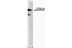 Western blot analysis of CD49b (Integrin alpha2) on a HeLa cell lysate (Human cervical epitheloid carcinoma, ATCC CCL-2.