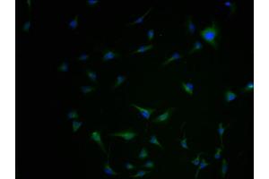 Immunofluorescence staining of U251 cells with ABIN7145025-IF at 1:100, counter-stained with DAPI. (Kir2.2 抗体  (AA 182-433))