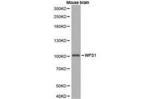 Western Blotting (WB) image for anti-Wolfram Syndrome 1 (WFS1) antibody (ABIN1875347) (WFS1 抗体)