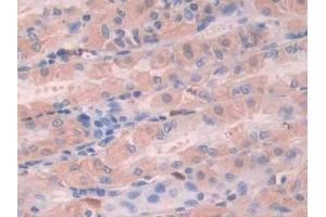 Immunohistochemistry (IHC) image for anti-Stanniocalcin 1 (STC1) (AA 28-247) antibody (ABIN7435202)