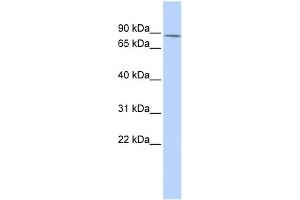 WB Suggested Anti-ZNF667 Antibody Titration:  0. (ZNF667 抗体  (Middle Region))