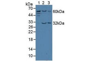 Western blot analysis of (1) Human Jurkat Cells, (2) Human HeLa cells and (3) Human K562 Cells. (TRF2 抗体  (AA 144-438))